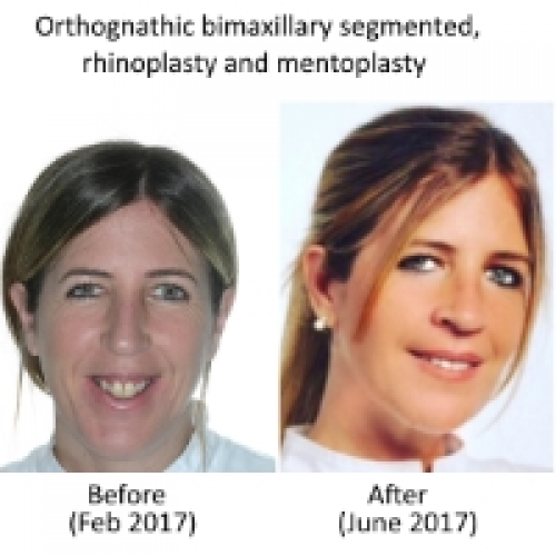 Foto Institut CEM (Cirug�a Est�tica y Maxilofacial)